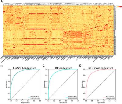 Machine learning based on metabolomics reveals potential targets and biomarkers for primary Sjogren’s syndrome